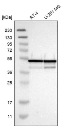 NUDCD3 Antibody, Novus Biologicals:Antibodies:Primary Antibodies